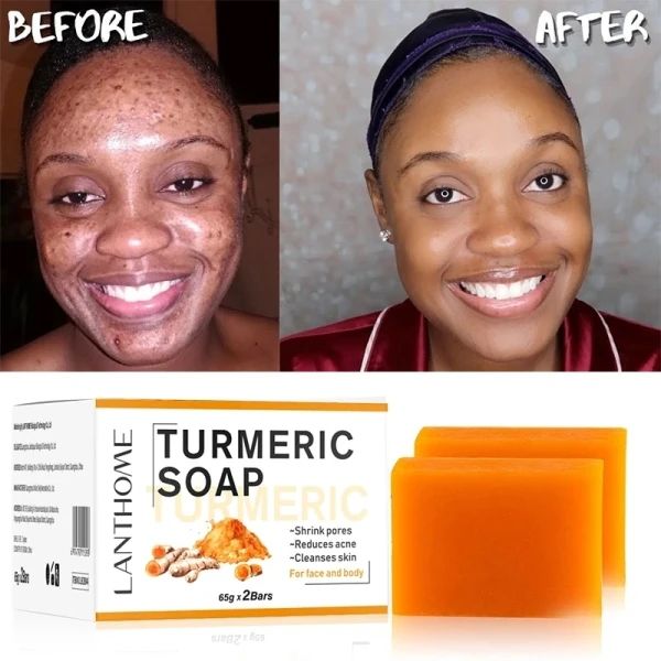 Tumeric soap