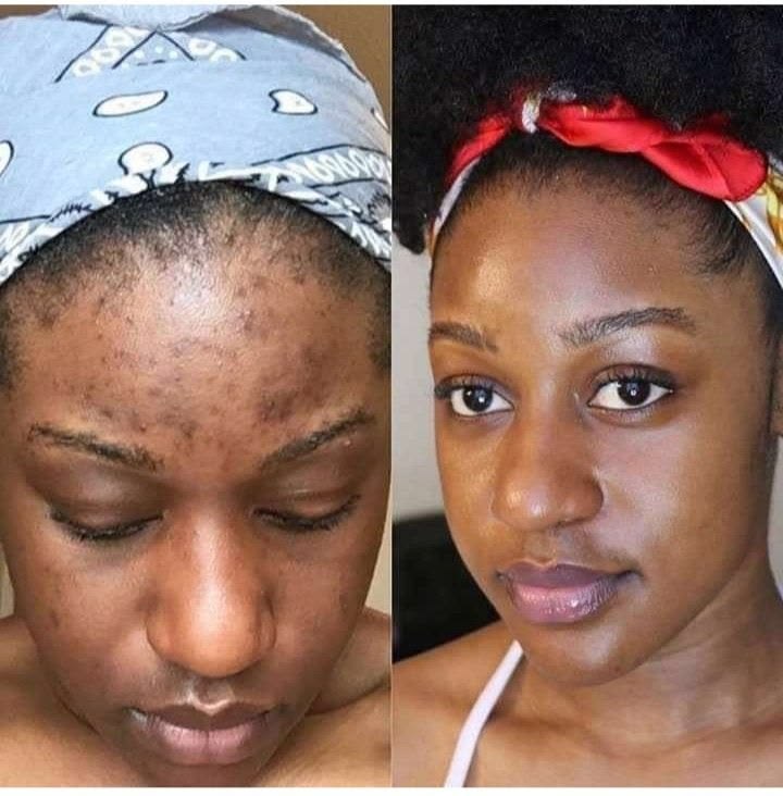 Tumeric soap