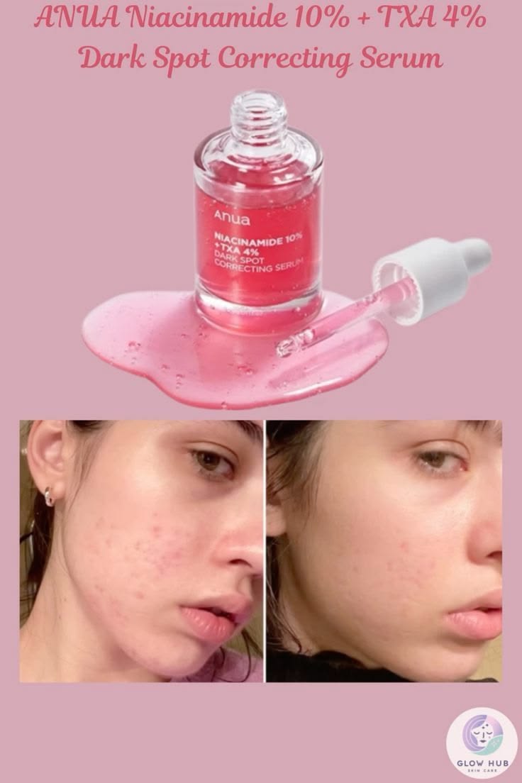 Anua Niacinamide 10% + TXA 4% Dark Spot Correcting Serum