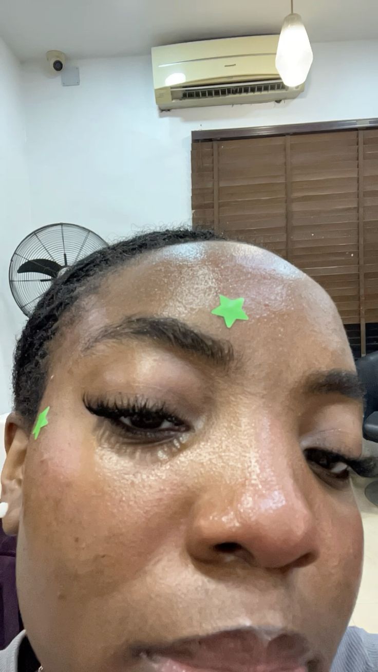 Pimples patch 1.0