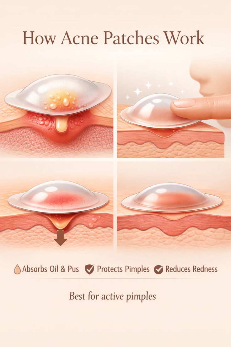 Pimples patch 1.0
